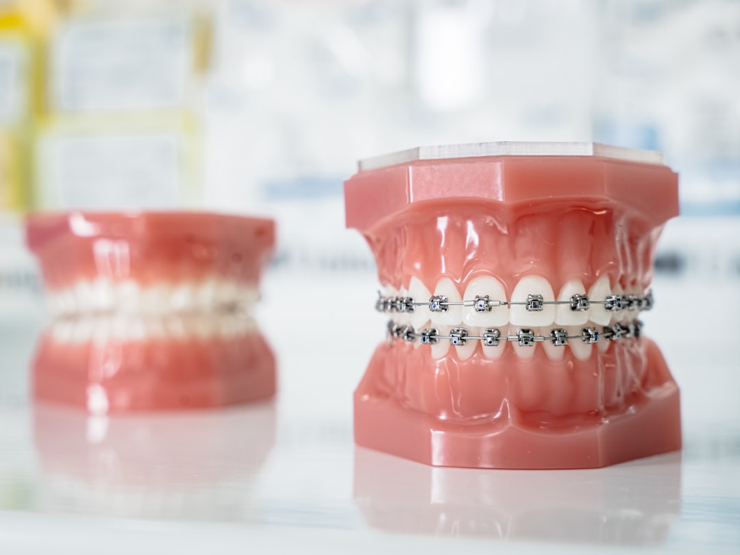 a-close-up-of-a-tooth-with-braces-on-it-p8ernb-ht-m